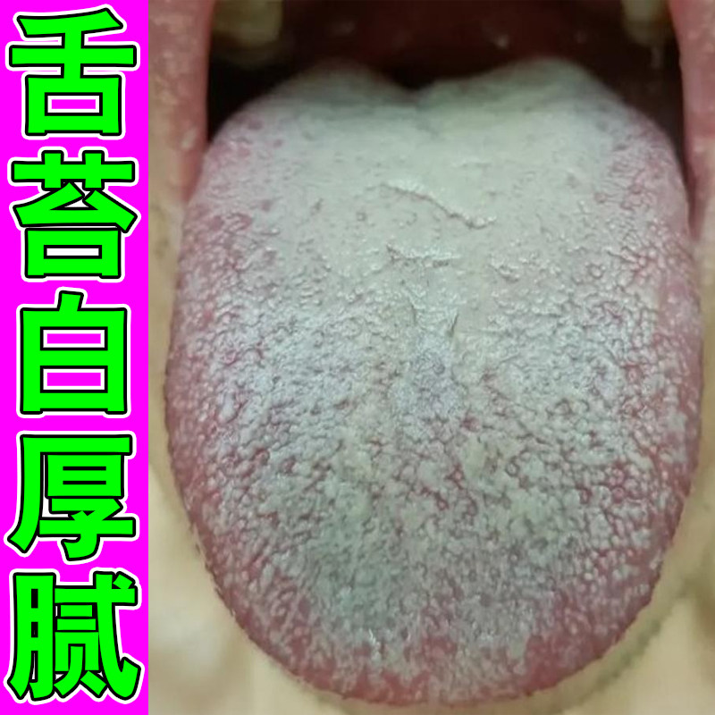 舌苔白厚腻舌裂纹有齿痕儿童老年人口腔有异味口臭调理贴膏药脾胃