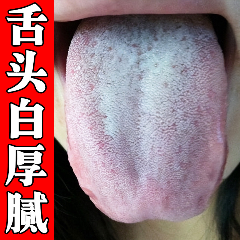 舌苔白厚舌头裂纹有齿痕脾胃虚肚子胀气口腔有异味臭成人儿童专用