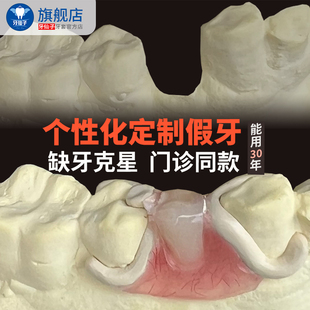 定制隐形假牙活动义齿树脂门牙掉缺牙镶牙种植牙临时修复门诊同款