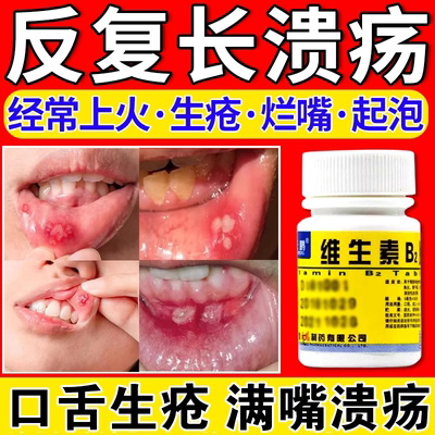 维生素b2片100片正品官方旗舰店 口腔溃疡口舌生疮上火起泡专用药