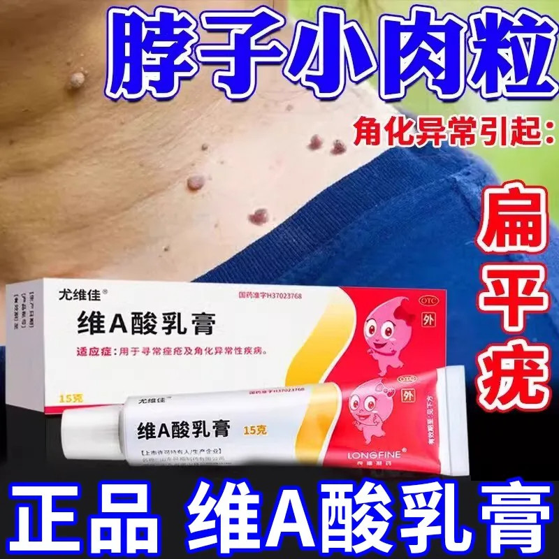 维a酸乳膏扁平疣脖子长小肉粒疙瘩丝状疣痤疮去疣医用官方旗舰店