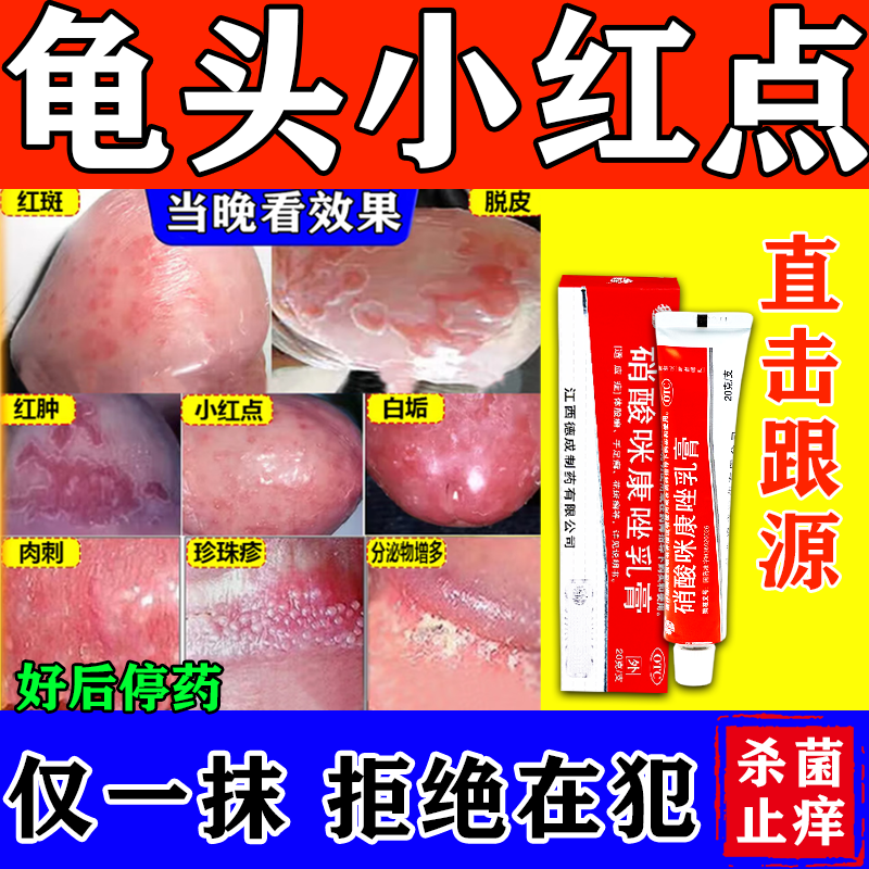 龟头炎专用药龟头红点瘙痒霉菌性龟头炎真菌感染男科用药包皮炎