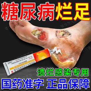 糖尿病引起皮肤感染烂足专用老年人血糖高引起脚溃烂皮肤痒痛