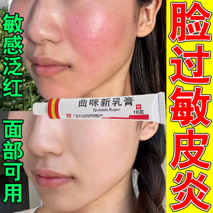 脸部过敏专用药皮肤特止痒效药膏干燥瘙痒脂溢性接触皮炎红肿皮炎