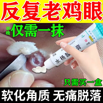 水杨酸软膏软化角质抑菌正品官方旗舰店医外用高浓度去鸡眼皮药膏
