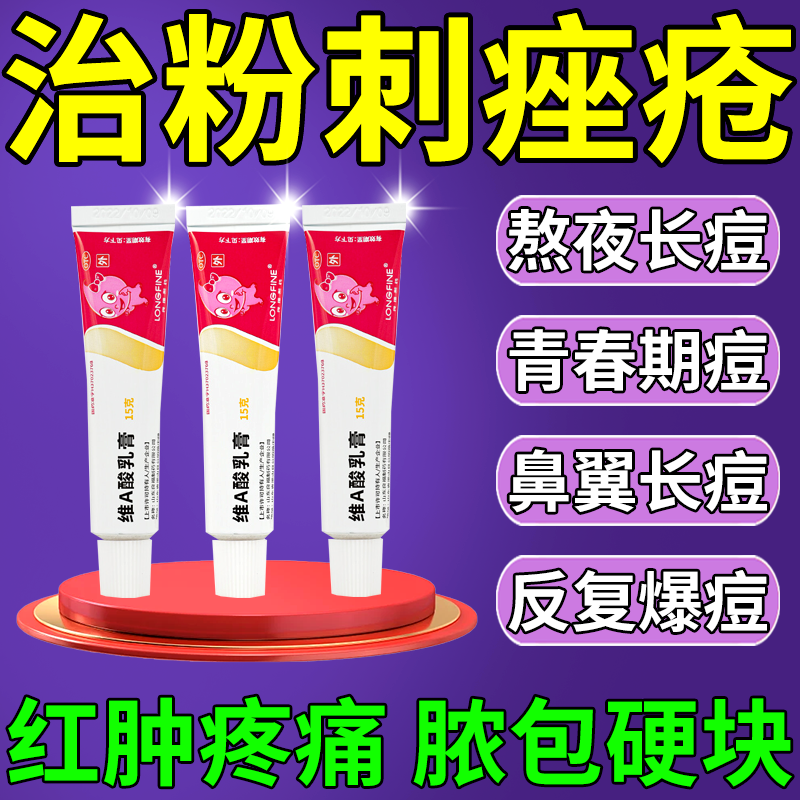 消痤疮粉刺专用药治红痘痤疮粉刺的药痤疮特药维a酸乳膏