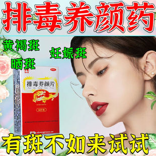 内调黄褐雀斑排毒养颜片胶囊官方旗舰店去斑祛黄褐斑雀斑官方正品