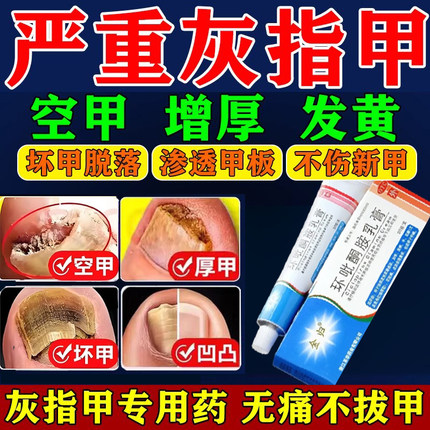 环吡酮胺乳膏灰指甲抑菌液亮甲专用特新效药膏正品旗舰店脱甲药膏