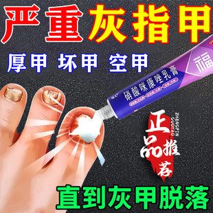 治疗去灰指甲专用药水膏脱甲癣藓除正品旗舰店真菌感染手脚甲沟炎
