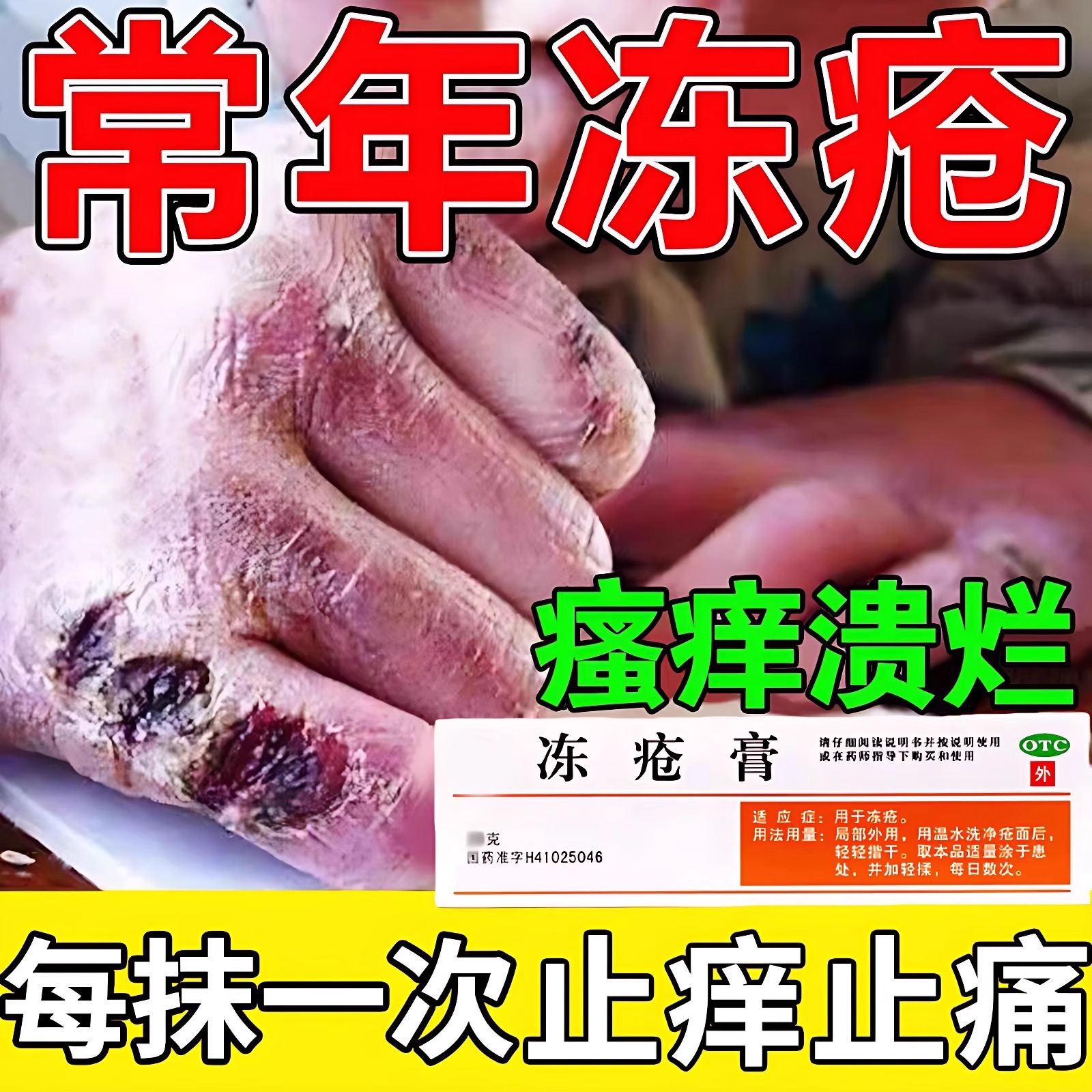 冻疮膏止痒冻伤膏正品肝素钠乳膏防冻疮防裂防儿童手足耳朵冻伤药