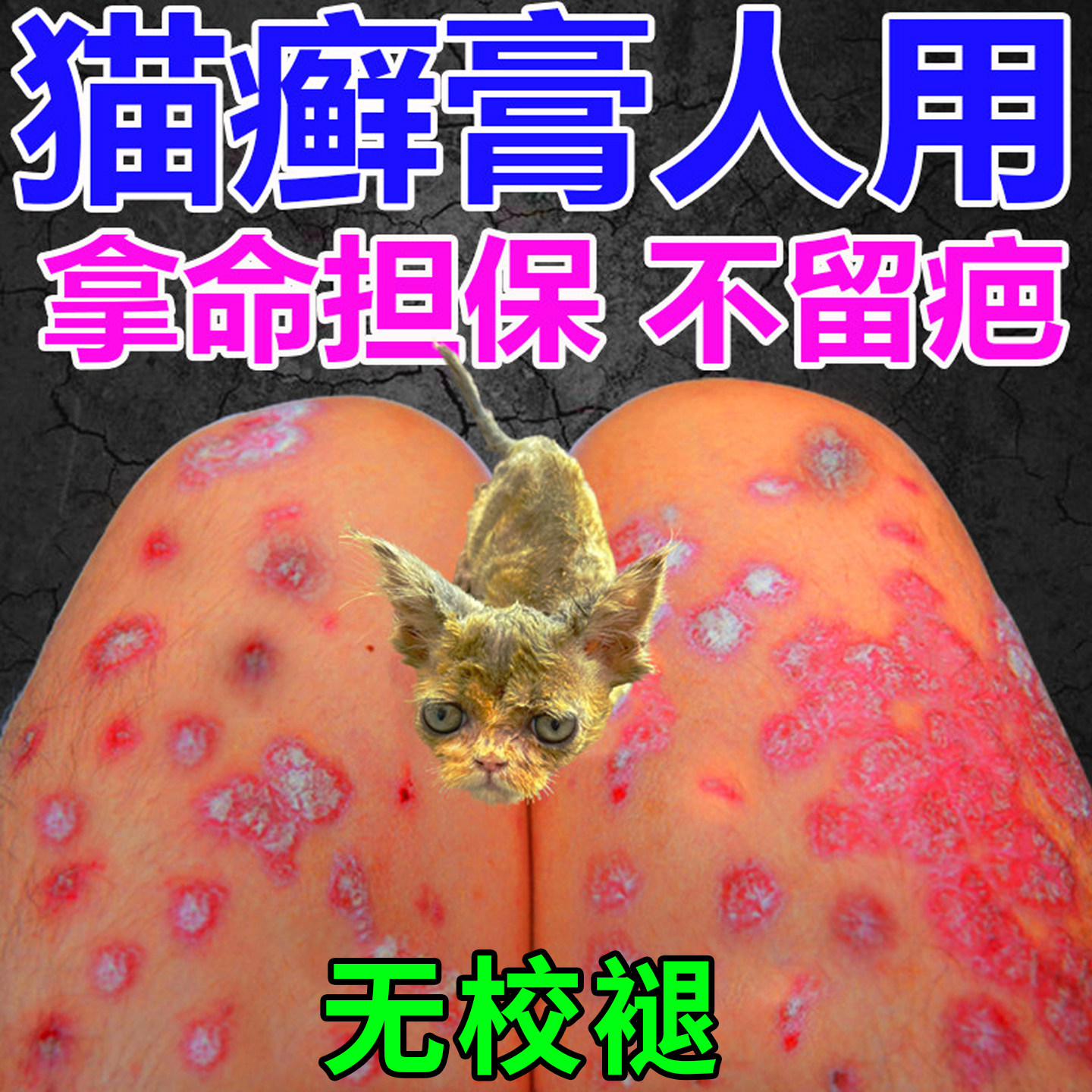 人用猫癣药猫癣外用药猫癣专用人得了猫癣人患真菌痒药膏特效