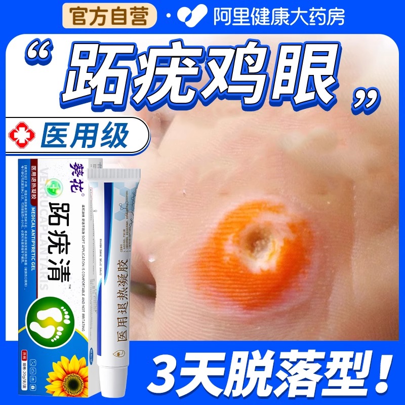 药房同售丨热销2w+跖疣专用膏