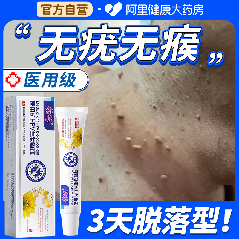 【二类器械】去疣瘊小肉粒NO.I