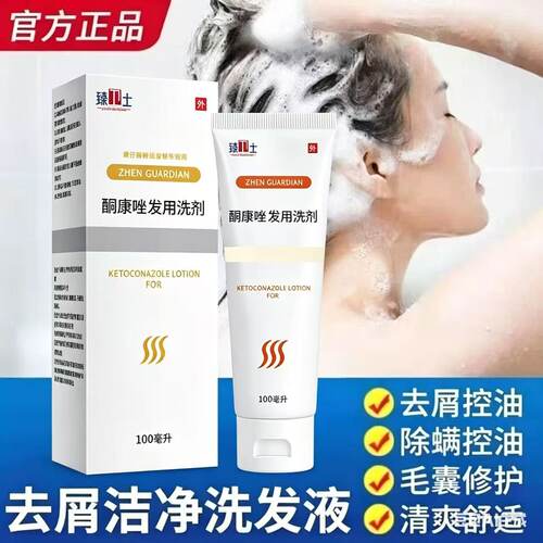 【药店同款】酮康强效去屑痒洗发水清洁去头皮经典老牌子洗发露