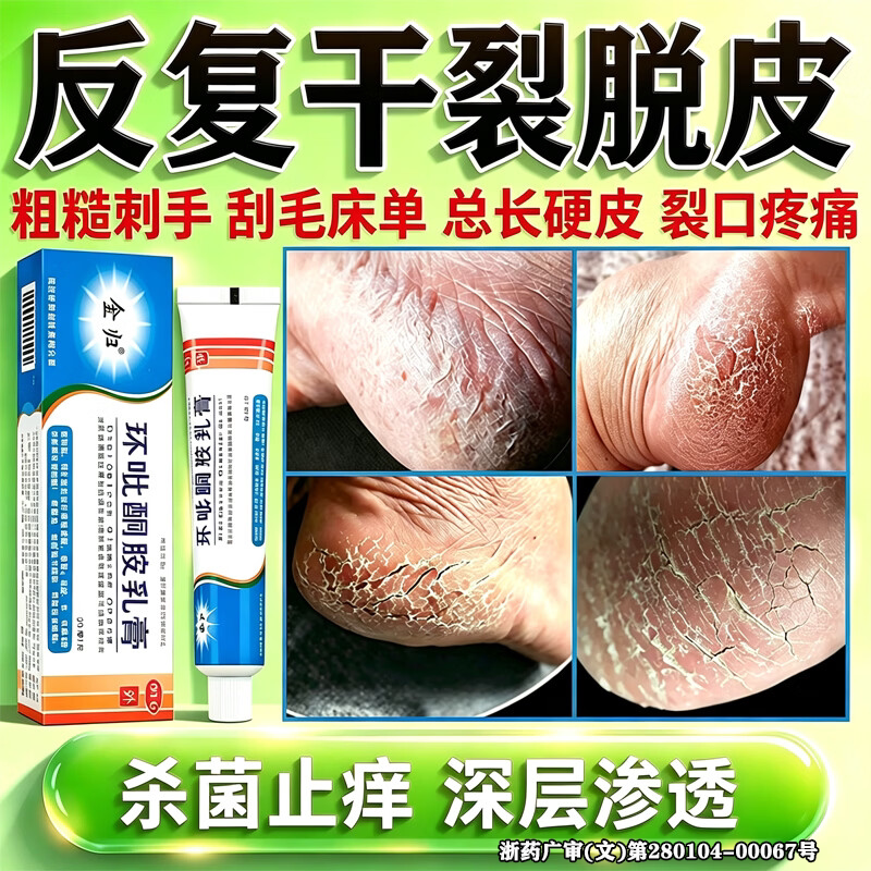环吡酮胺乳膏脚后跟干裂起硬皮足跟开裂脚气止痒脱皮杀菌真菌感染