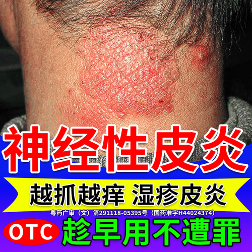 【白云山】复方醋酸地塞米松乳膏0.075%1%1%*20g*1支/盒