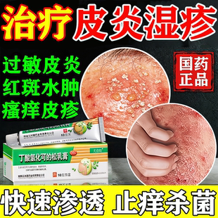 丁酸氢化可的松乳膏正品湿疹过敏性脂溢性皮炎瘙痒外用止痒药膏