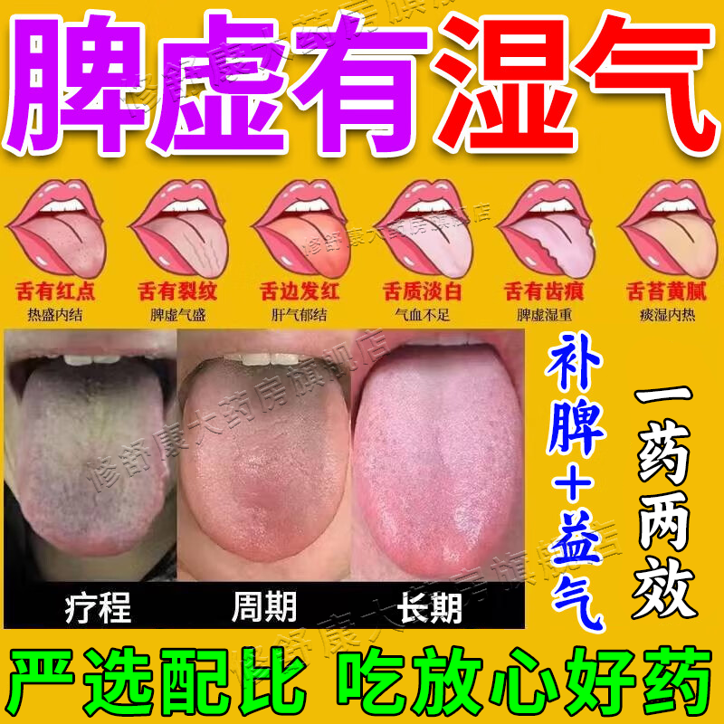 【扁鹊】参苓白术散6g*10袋/盒