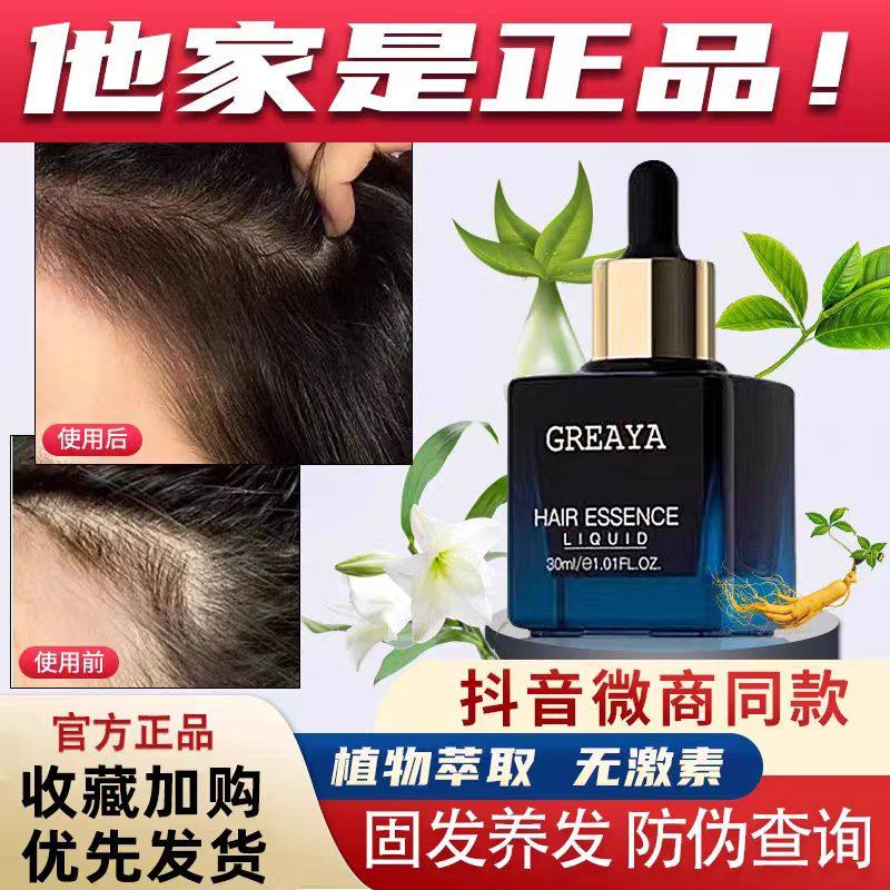 官方正品护发养发男女通用