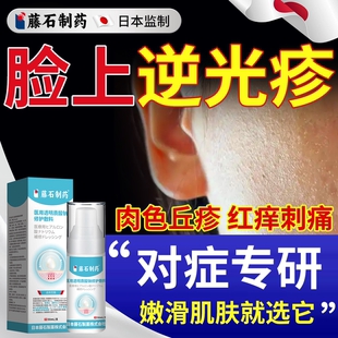 藤石制药医用透明质酸钠去逆光疹修复脸上起小疙瘩屏障闭口粉刺YS