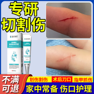 割伤愈合膏专用快速结痂久不愈合凝胶刀割划破皮肤疤痕药监备案YM