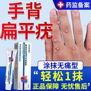 手背扁平疣膏去瘊子软膏一抹灵除面颈部专用祛丝状疣小肉粒神器YM