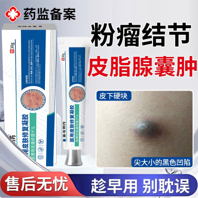 【医用级】粉瘤结节皮脂腺囊肿