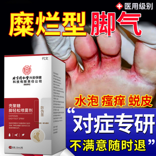 糜烂性脚气止痒脱皮杀菌真菌感染专用烂脚丫趾缝痒药房同款喷剂YM