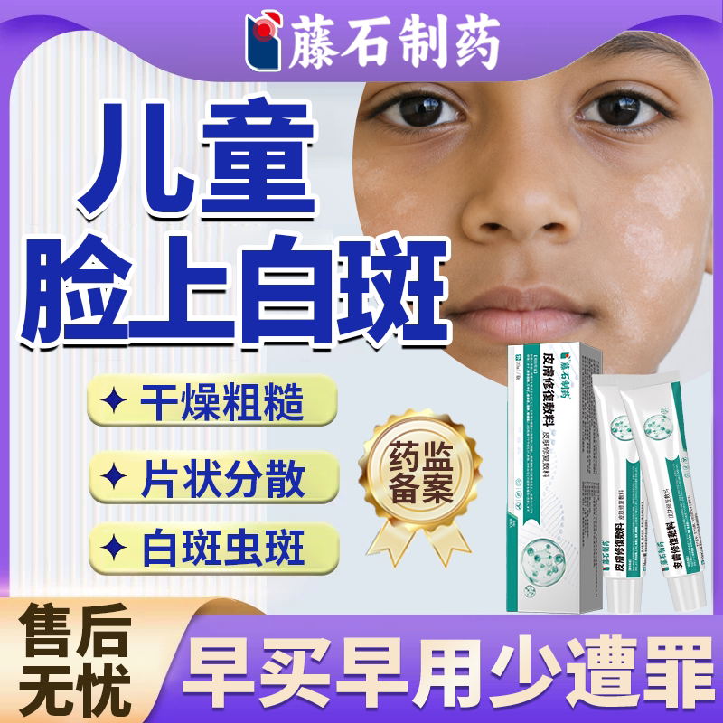藤石制薬白色糠疹药膏儿童脸上长白斑专用汗斑霜膏成人康疹可用MP