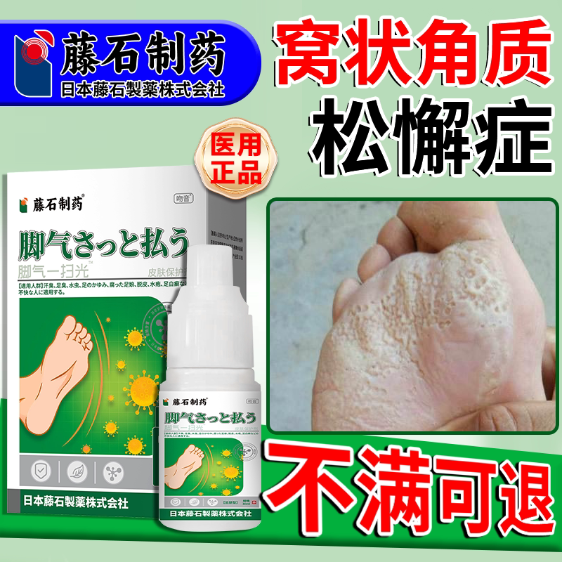 窝状角质松解症脚底起泡蜂窝状沙虫脚糜烂臭脚可搭角质型药膏用wy