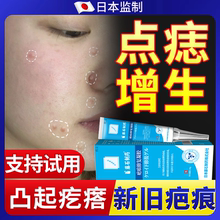 点痣后修复疤痕膏去疤痕祛痣贴红印祛疤膏除疤增生凸起去除疙瘩YS