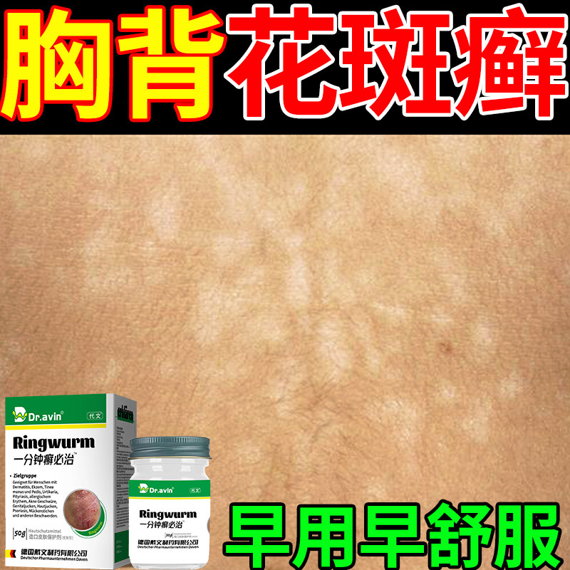 去胸背花斑癣膏前胸后背体癣汗斑净外用专用膏药监备案儿童成人pa