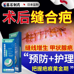 缝针疤痕修复除疤膏手术伤口刀口祛疤贴祛除甲状腺术后防增生贴YS