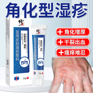 手部角化型湿疹手脱皮干裂真菌感染手干裂修复角质增厚专用膏YM