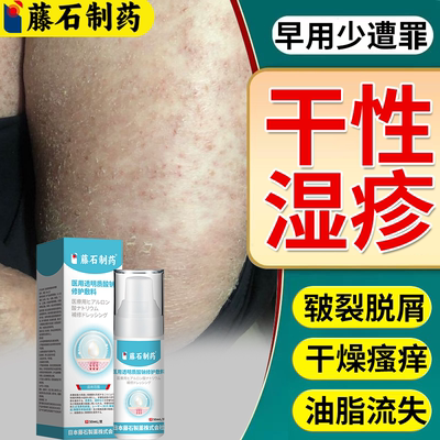速发】干性湿疹秋冬皮肤干燥瘙痒