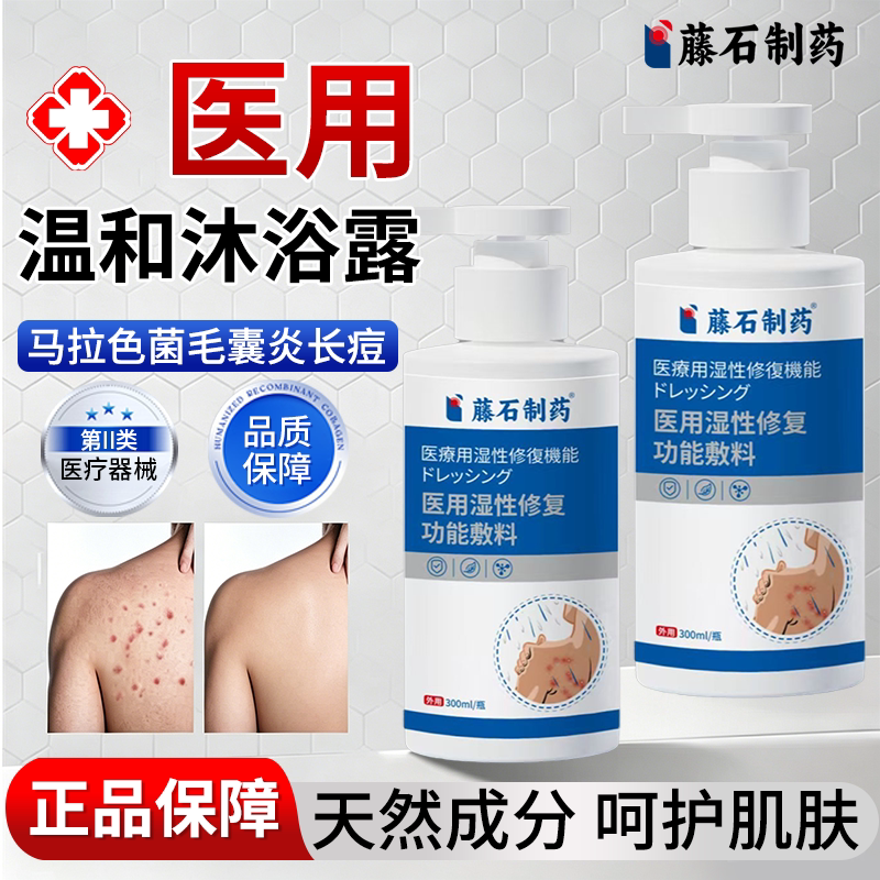 藤石制药马拉色菌沐浴露可搭二硫化硒医用二氧使用后背毛囊炎痘OZ