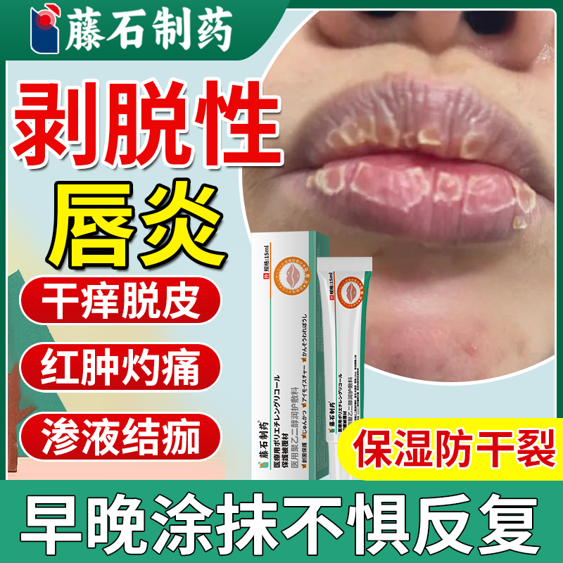 【速发】嘴巴剥脱性唇炎干燥脱皮