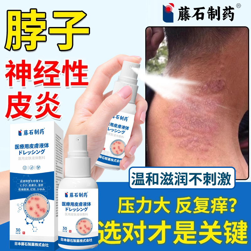 神经性皮炎喷剂皮炎湿疹痤疮瘙痒