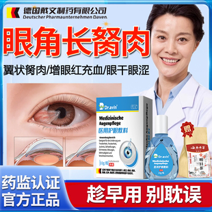 医用去眼角长翼状息肉滴眼液除眼睛胬肉赘肉眼模糊可搭眼药水用YM