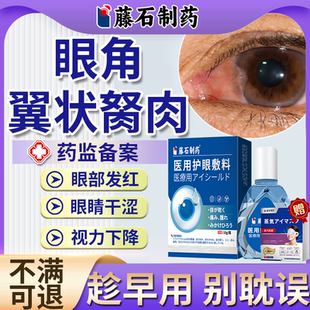 去除眼睛胬肉眼角长翼状胬肉息肉眼异物感专可搭滴眼液眼药水用EM