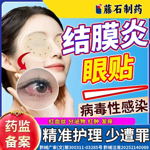 眼睛红血丝痛痒专用冷敷贴结膜炎
