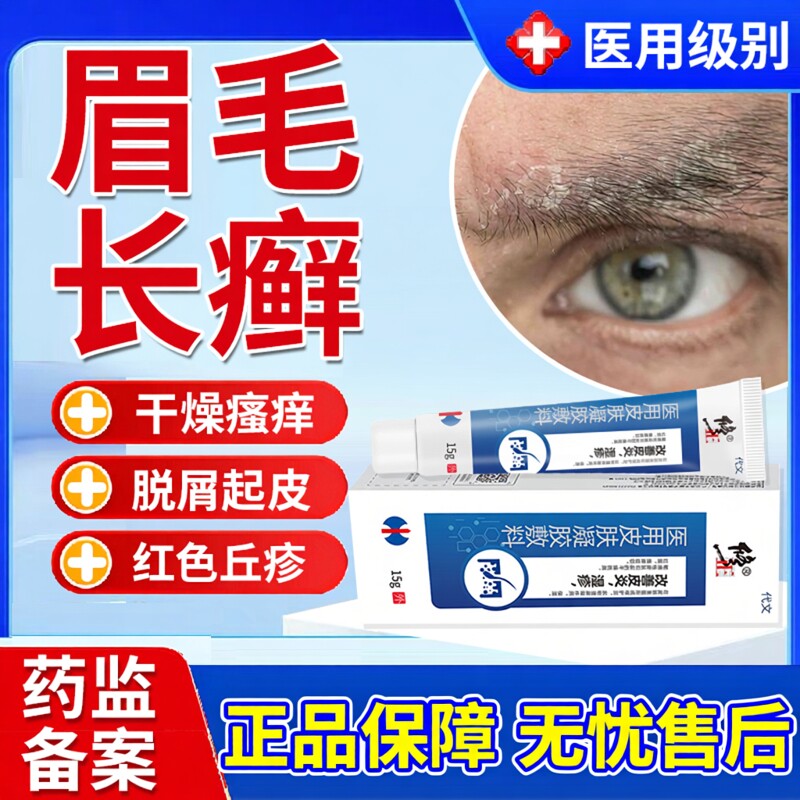 眉毛脂溢性皮炎面部起皮长癣脸上鼻翼子两侧干红痒脱皮掉屑凝胶YM