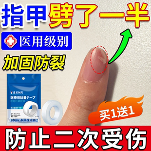指甲劈了断裂劈裂手指甲盖受伤边缘裂口开裂护甲套保护贴医用级JW