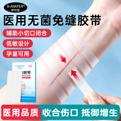 医用拉链皮肤减张贴减张器疤痕伤口愈合贴免缝胶带剖腹产术后防宽