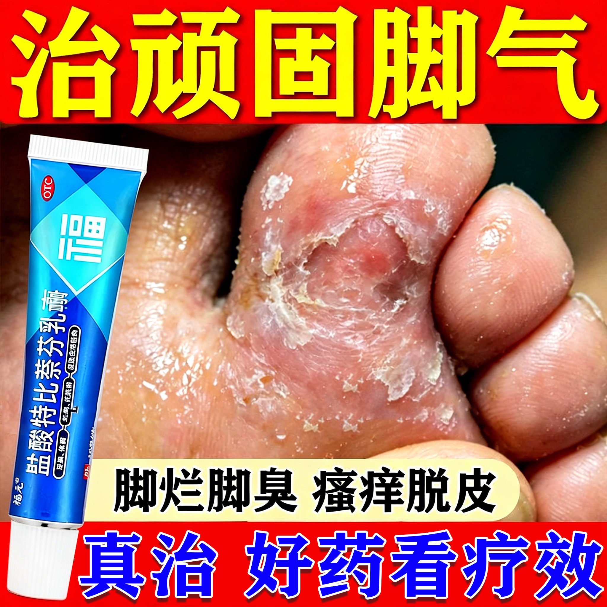 盐酸特比萘芬乳膏正品抗真菌脚气烂脚丫药脱皮糜烂趾官方旗舰店