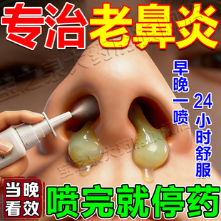 复方熊胆通鼻喷雾剂过敏性鼻炎鼻窦炎专用效特药鼻塞断流鼻涕膏根