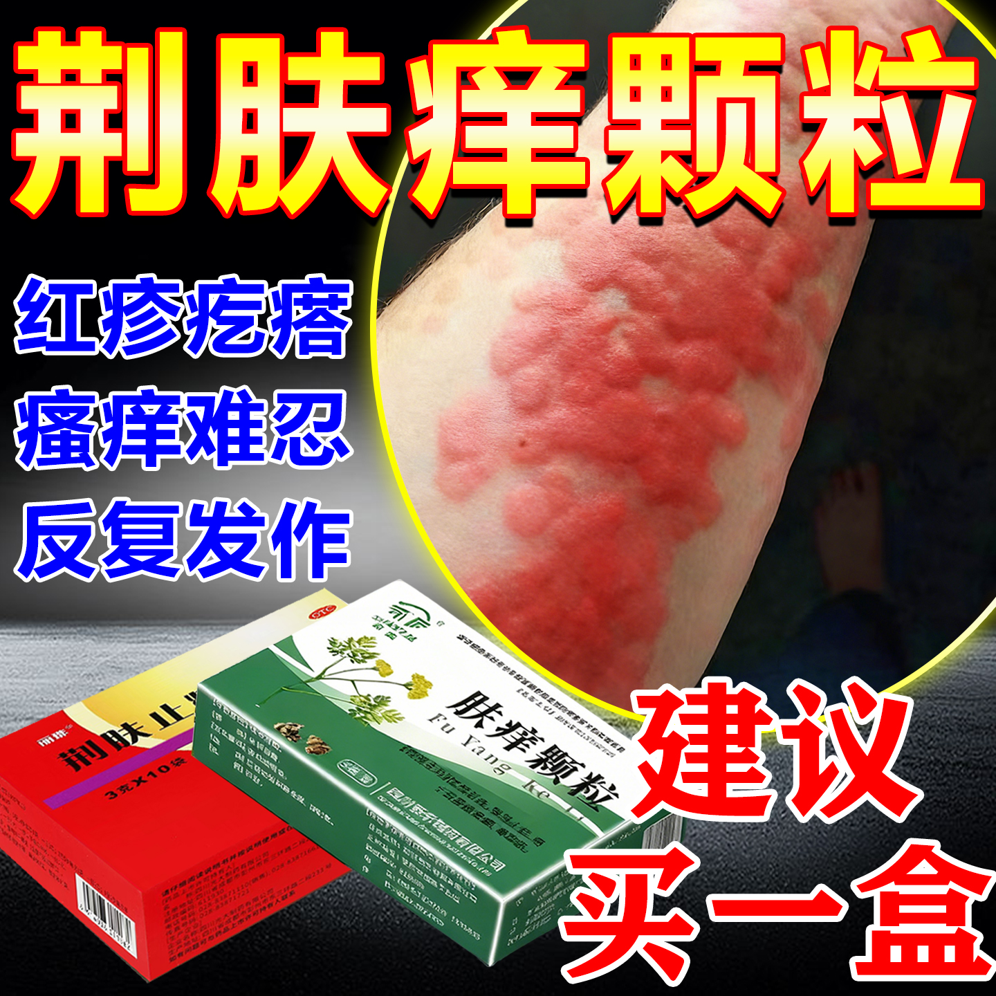 荆止痒肤痒颗粒正品治疗荨麻疹特新效药皮肤过敏断痒止痒根专用药