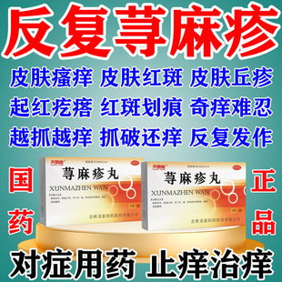 荨麻疹皮肤瘙痒专用药治疗荨麻疹皮肤特痒止痒有效药荨麻疹丸