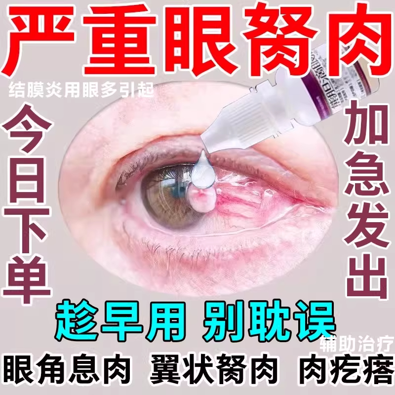 【鑫烨】苄达赖氨酸滴眼液5ml*1支/盒眼睛胬肉眼角息肉翼状胬肉肉疙瘩异物感