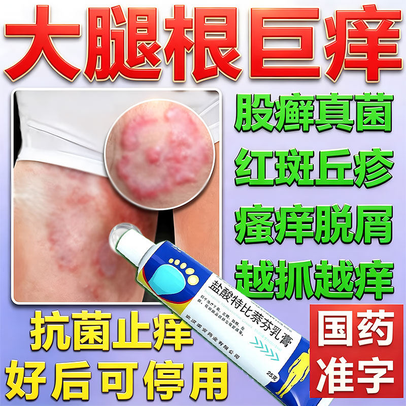 [嘉效]盐酸特比萘芬乳膏1%*25g*1支/盒